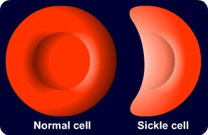 Diagram - Inherited Diseases
